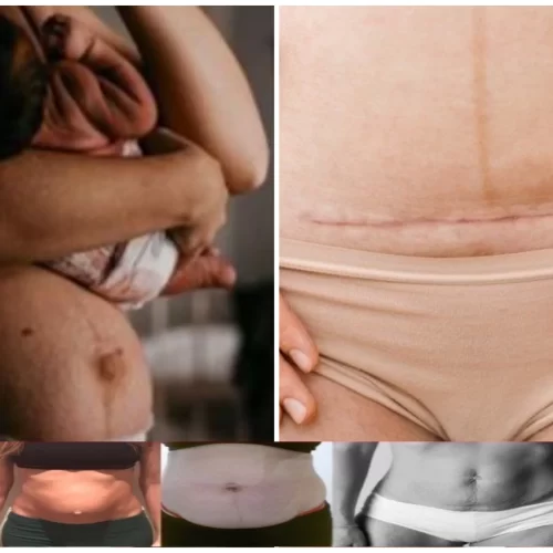Maternidade Livre de Pressões: Desafiando os Padrões Estéticos